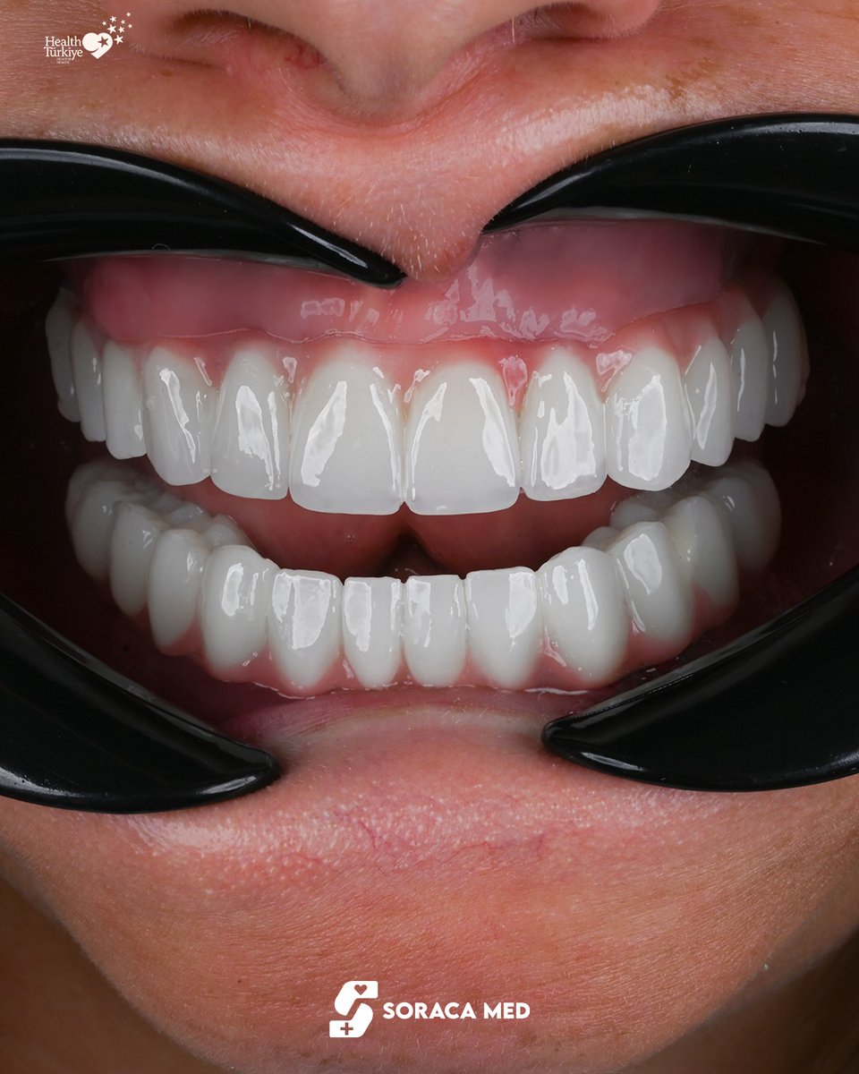 soracamed's tweet photo. ✨ Smile Makeover in Antalya

Inessa’s transformation says it all 🦷
A brighter, natural, and more confident smile with our personalized dental treatment at Soraca Med.
✔ Natural-looking veneers &amp; crowns
✔ Expert dental team
✔ Premium materials
https://t.co/1VFItl23Ki https://t.co/2Zo6TywBMM