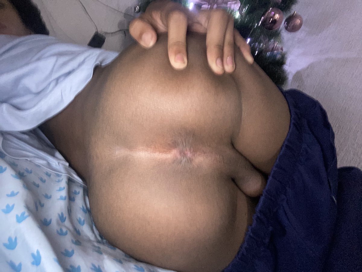 Dilanpollito tweet media