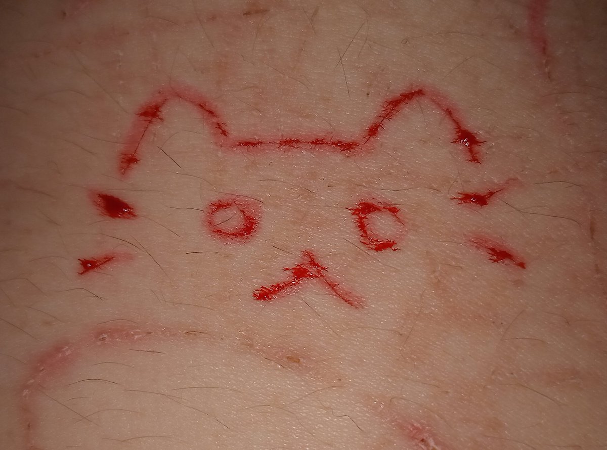 Shadi 🐸🌱💧(Tsuyu of shtwt) tweet media