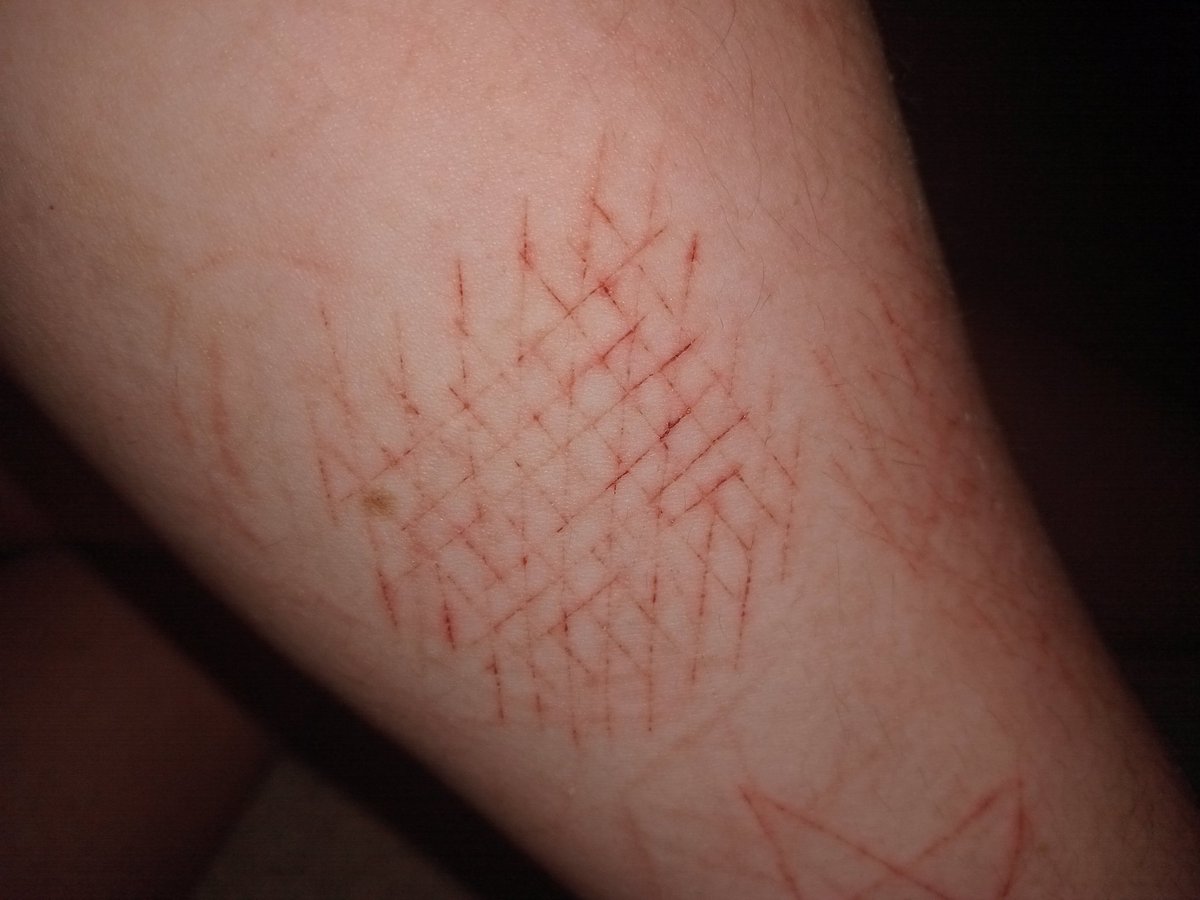 Shadi 🐸🌱💧(Tsuyu of shtwt) tweet media