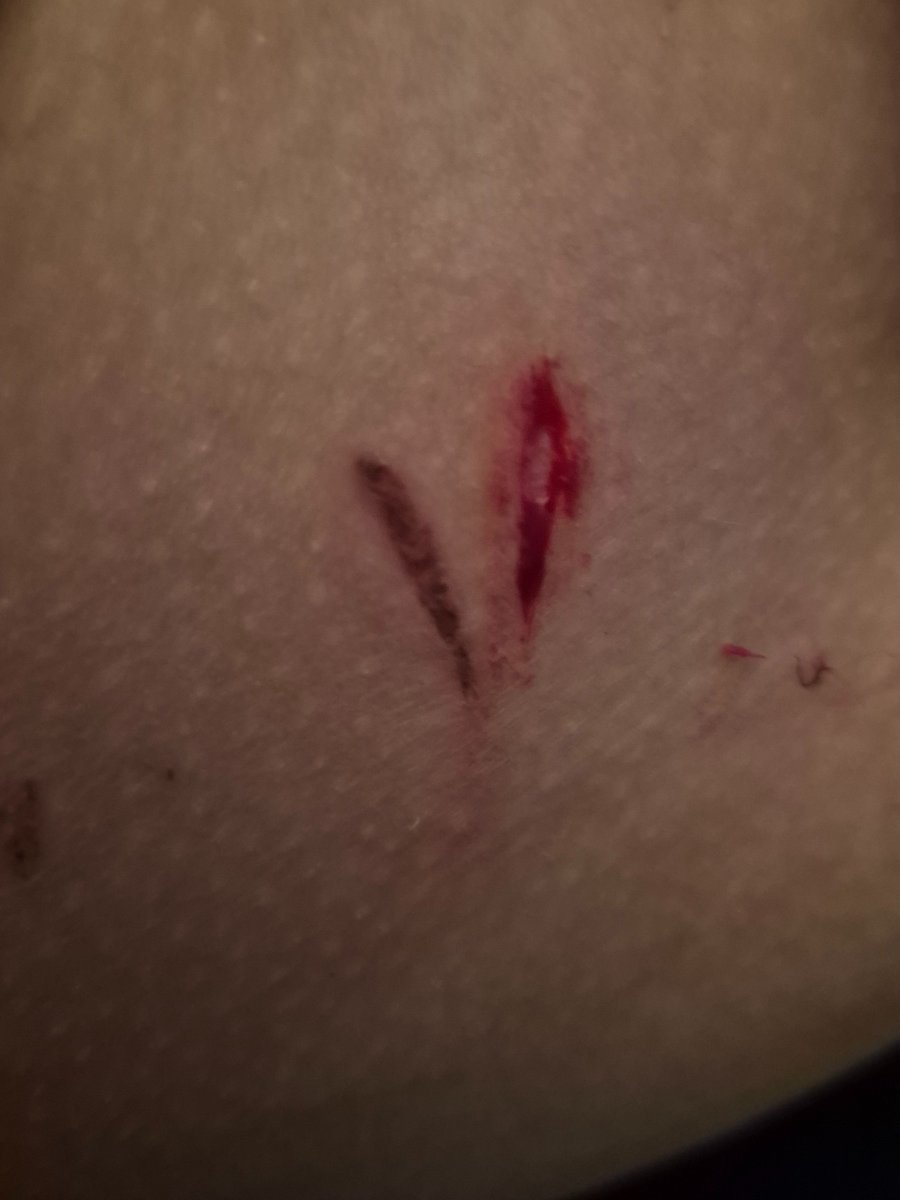 𝕊𝕦𝕟𝕟𝕪_𝕚𝕤_𝔽𝕒𝕕𝕚𝕟𝕘 {𝕊𝕙𝕥𝕨𝕥} tweet media