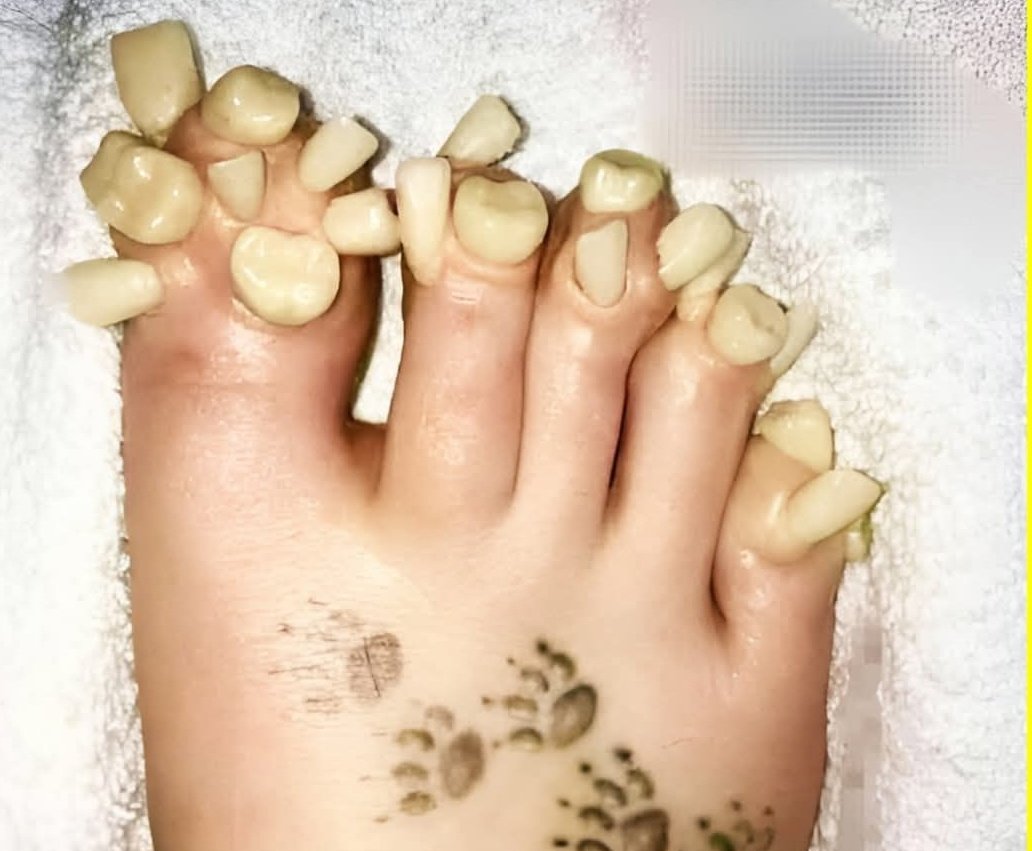 Wellness_Tosin tweet media