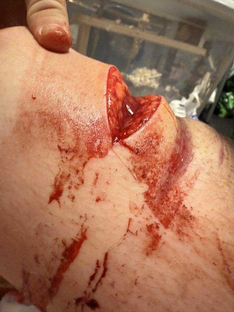 porcelain of shedtwt tweet media