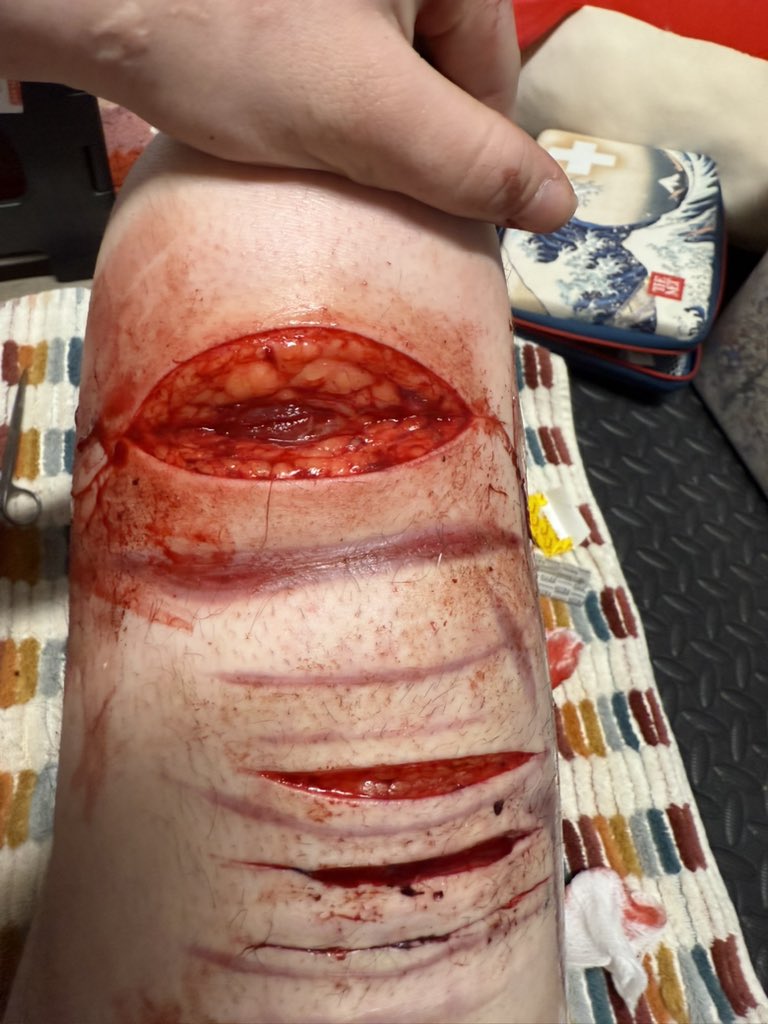 porcelain of shedtwt tweet media