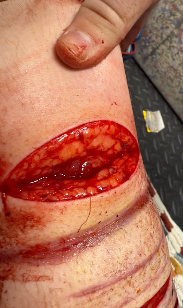 porcelain of shedtwt tweet media