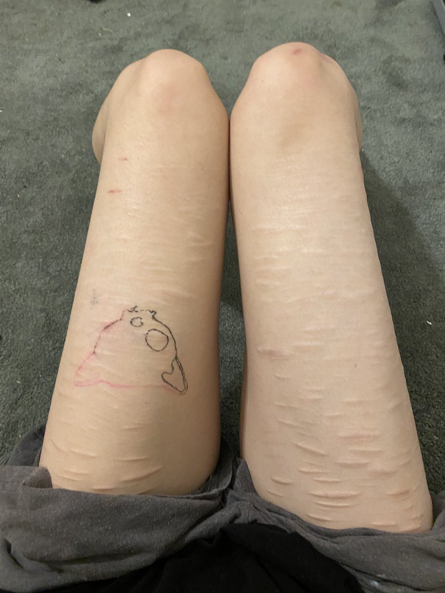 xan GYM ERA tweet media