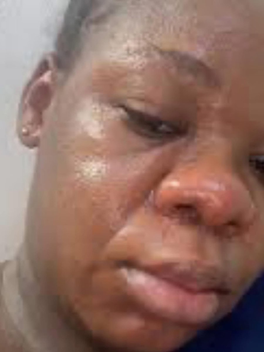 Dammi_Esq's tweet photo. I’m a woman who has been married for just one year. Last night, I was forced to sleep outside, and today I moved back to my parents’ house while seven months pregnant. My only “offense” is getting pregnant for the man who married me.

I didn’t disrespect my husband or do anything to provoke him. But ever since I got pregnant, he has constantly complained that I’ve become ugly. He has never made me happy throughout this pregnancy he makes me cry almost every day with hurtful words.

I kept enduring it, hoping things would change after I gave birth. Deep down, I knew the marriage might not last because he often said he regretted marrying me and wouldn’t have done so if he knew I would “look like this.”

As my pregnancy progressed, the insults got worse. He would call me ugly, mock my nose, say my mouth smells, and compare me to other women. He even insulted me in public, which made me withdraw and avoid going out with him. I mostly stayed indoors unless I had to go to work.

Last month, he started asking me to go back to my parents’ house because, according to him, my face scared him. I refused because I contributed to the rent. Still, he kept repeating it daily and threatening to throw me out.

Yesterday morning, he told me to leave before he returned. I didn’t go. When he came back around 10pm, he insulted me for hours and eventually threw me out around 1am. I had to find somewhere else to sleep before going to my parents’ house this morning.

Nothing happened no fight, no wrongdoing. I simply got pregnant, and suddenly the man I’ve been with for four years says I’m too ugly to be his wife.

My heart is broken. I haven’t spoken to anyone since I got here because I don’t even know how to explain to my parents and younger siblings that my husband sent me away at seven months pregnant just because he thinks I’m ugly. 😭

©️ loveandpills_kwaku
