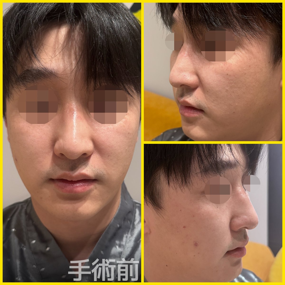 バナナ美容整形外科🍌 tweet media