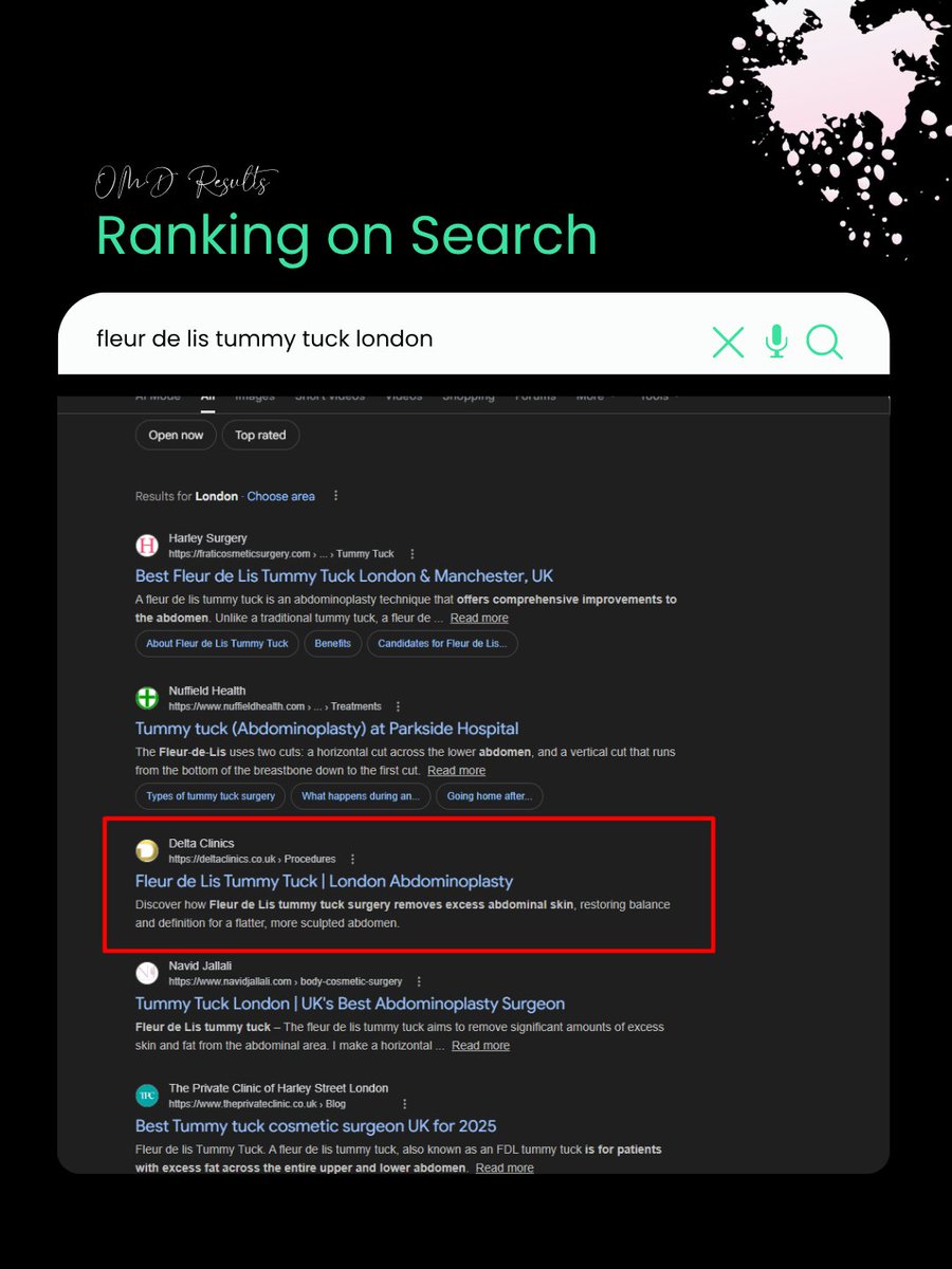 OMDGlobal's tweet photo. Google Search is where patient decisions start.
Happy to see our UK client ranking for “fleur de lis tummy tuck london” and showing up where it matters most, right when patients are actively searching.
#seoforclinics #plasticsurgeryseo #medicalmarketing #onlinemarketingfordoctors https://t.co/aSKmejthAD