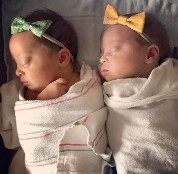 PreciousLifeCom's tweet photo. Doctors told me six times to abort my twins because they have Down Syndrome
Rachel Prescott describes her twins as "her miracles" as the odds of having identical twins with Down Syndrome are just one in a million.
Read full article..
https://t.co/3DTMVTNdui
#dontscreenusout
#MakeAbortionUnthinkable