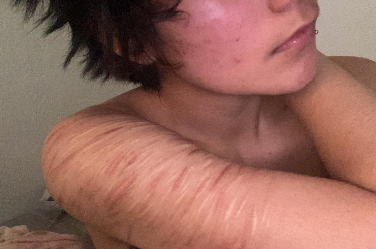 lev VOL.3 CON LIMIT tweet media