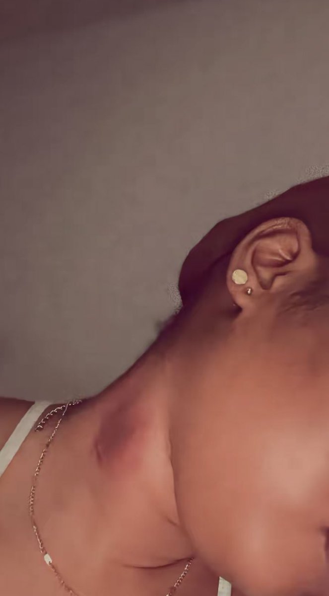 Ediomo💉💕 tweet media