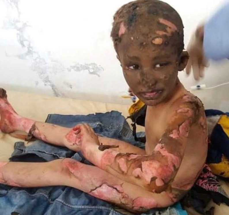 حليمة tweet media