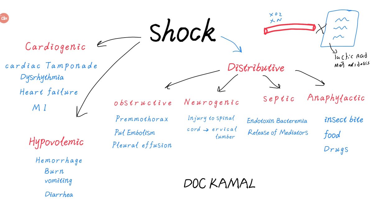 doc_kamal99's tweet photo. عملتلكم تلخيص لانواع ال shock واشهر الاسباب لكل نوع https://t.co/dWFT9cIpV2