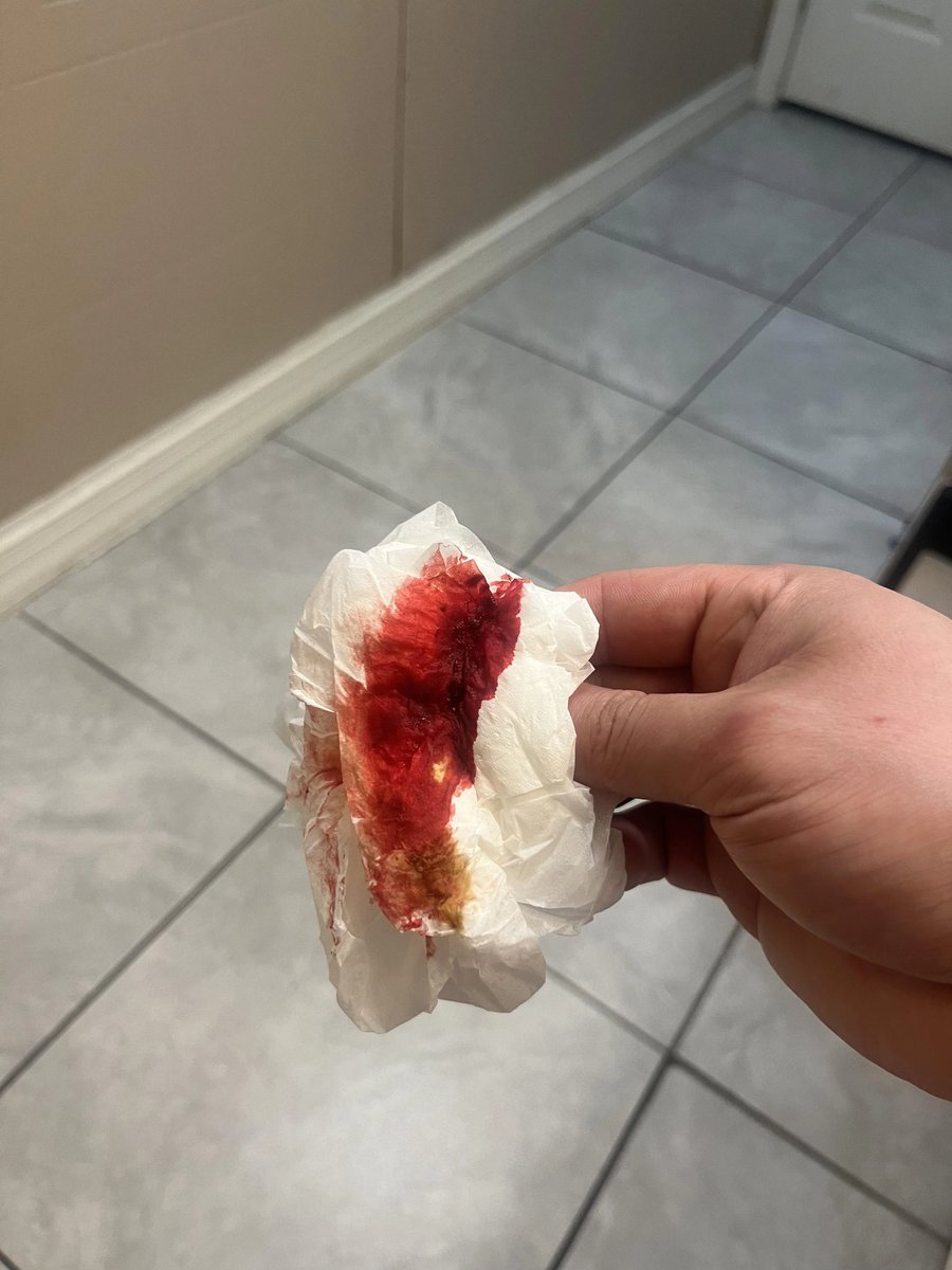 Dr Abdul Hameed 🩺 tweet media