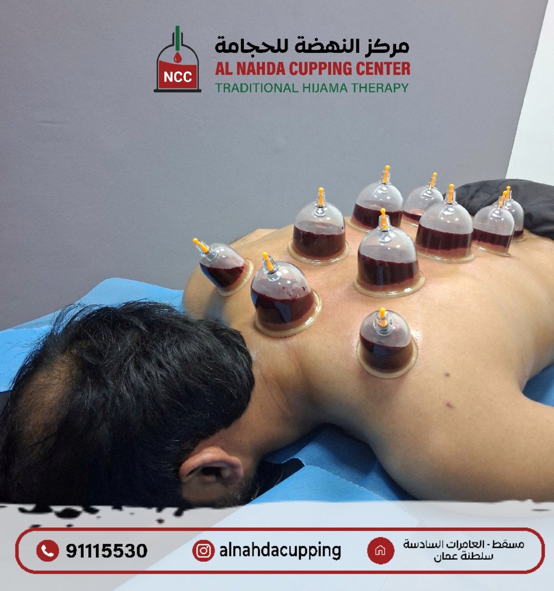 Mah777788's tweet photo. 💥 عرض خاص لفترة محدودة 💥

🩺 جلسة الحجامة الشاملة
✨  16 موضع حجامة
💆‍♂️  مع تدليك مجاني

🔥 فقط بـ 9 ريال 🔥
◆ ~بدلا من 16 ريال~

📍 استعيد نشاطك وتخلص من التعب والإرهاق
📅 احجز موعدك الآن قبل انتهاء العرض

تواصل معنا للحجز والاستفسار
📲  91115530 https://t.co/fHzLuJWh16