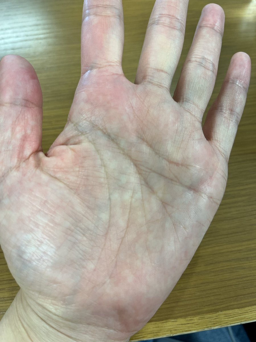 ポチ🐶茜チーフ tweet media