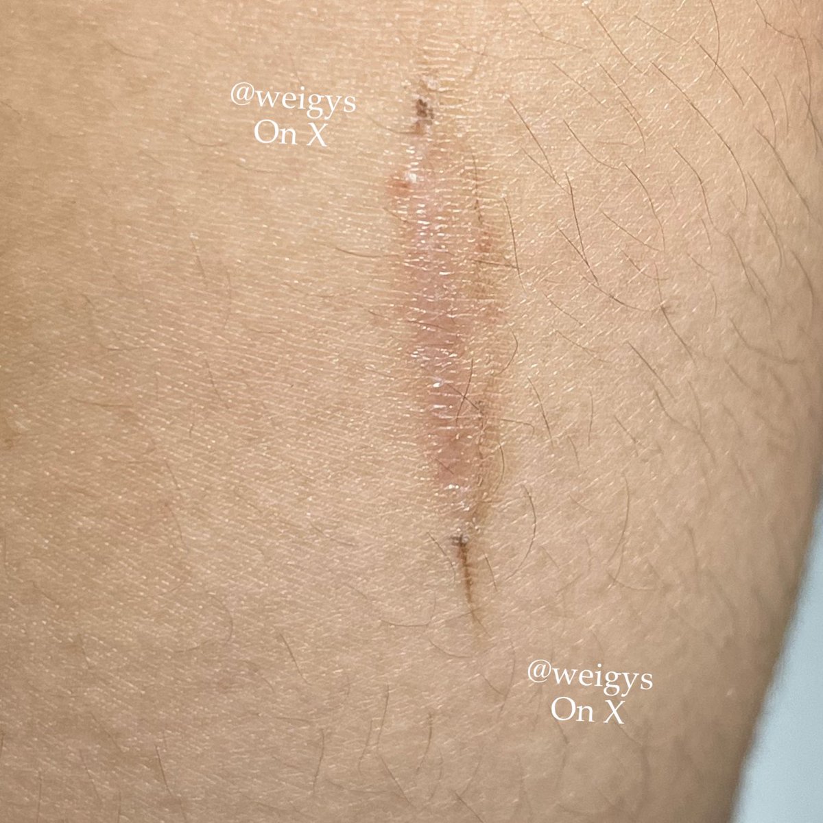 ️️ ️candlssl tweet media