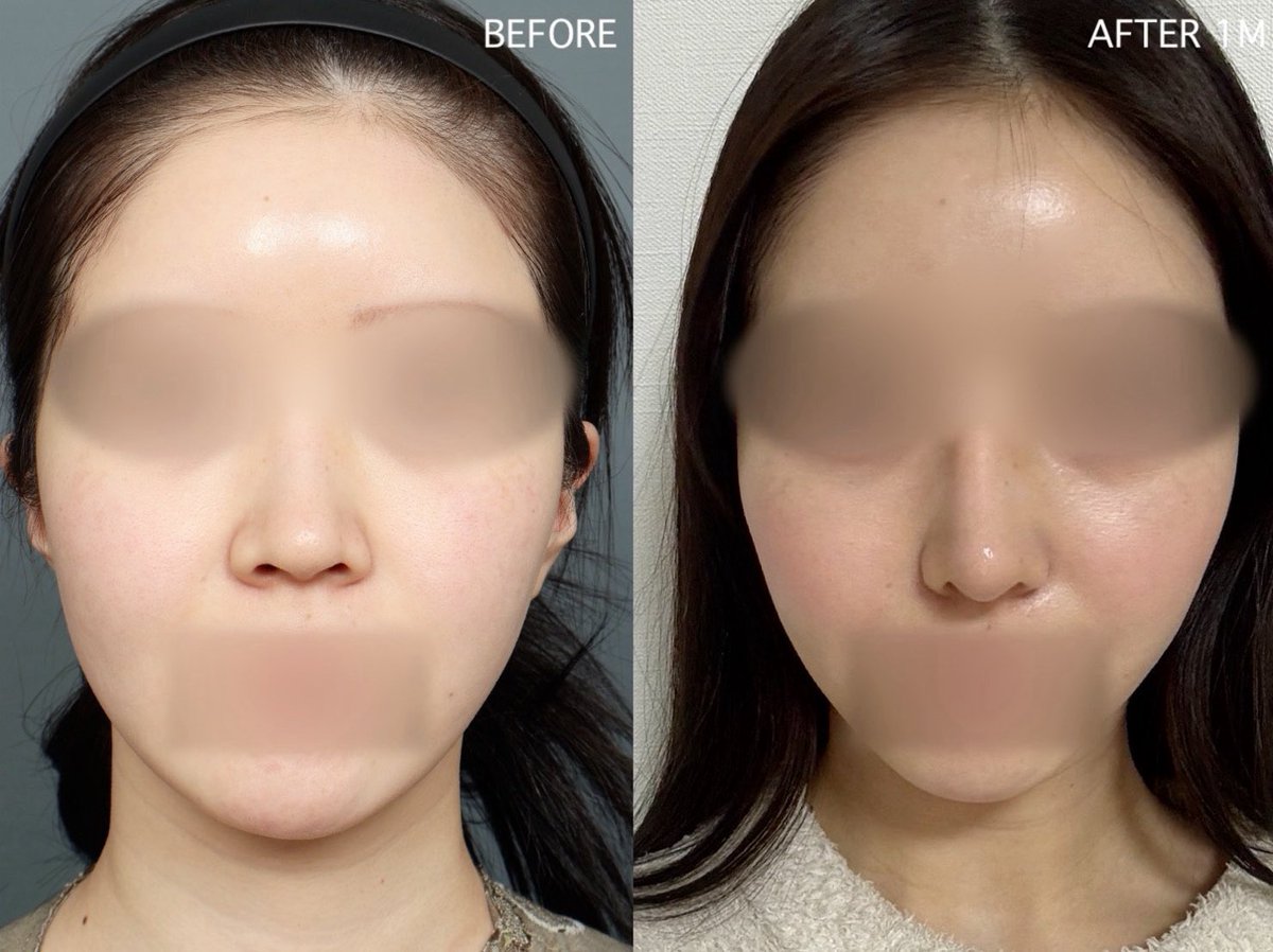 JT整形外科(輪郭・鼻・目専門) tweet media