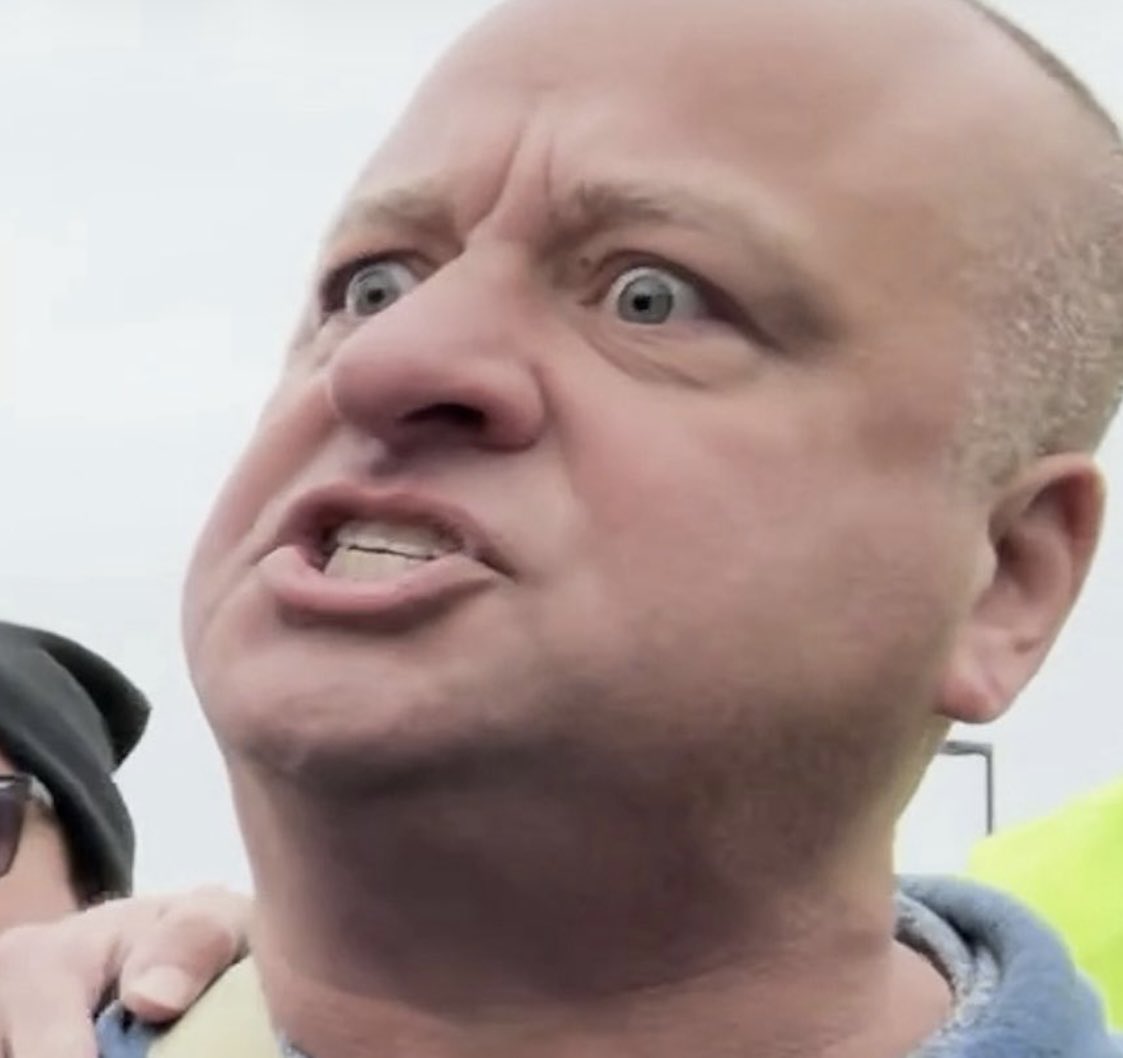 Bruh, what’s with your effin head? #MNAngryMan