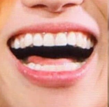 wooyogie's tweet photo. tópico sensível: o dentinho canino saltado do wooyoung ): https://t.co/wG17rHg0Dz