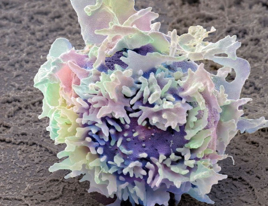 ScienceMagazine's tweet image. Depleting regulatory T cells from tumors boosts natural killer cell activation and antitumor activity against MHC I-deficient cancers in mice, which could inform future therapeutic strategies. 

Learn more in @SciImmunology: scim.ag/47RkUdD