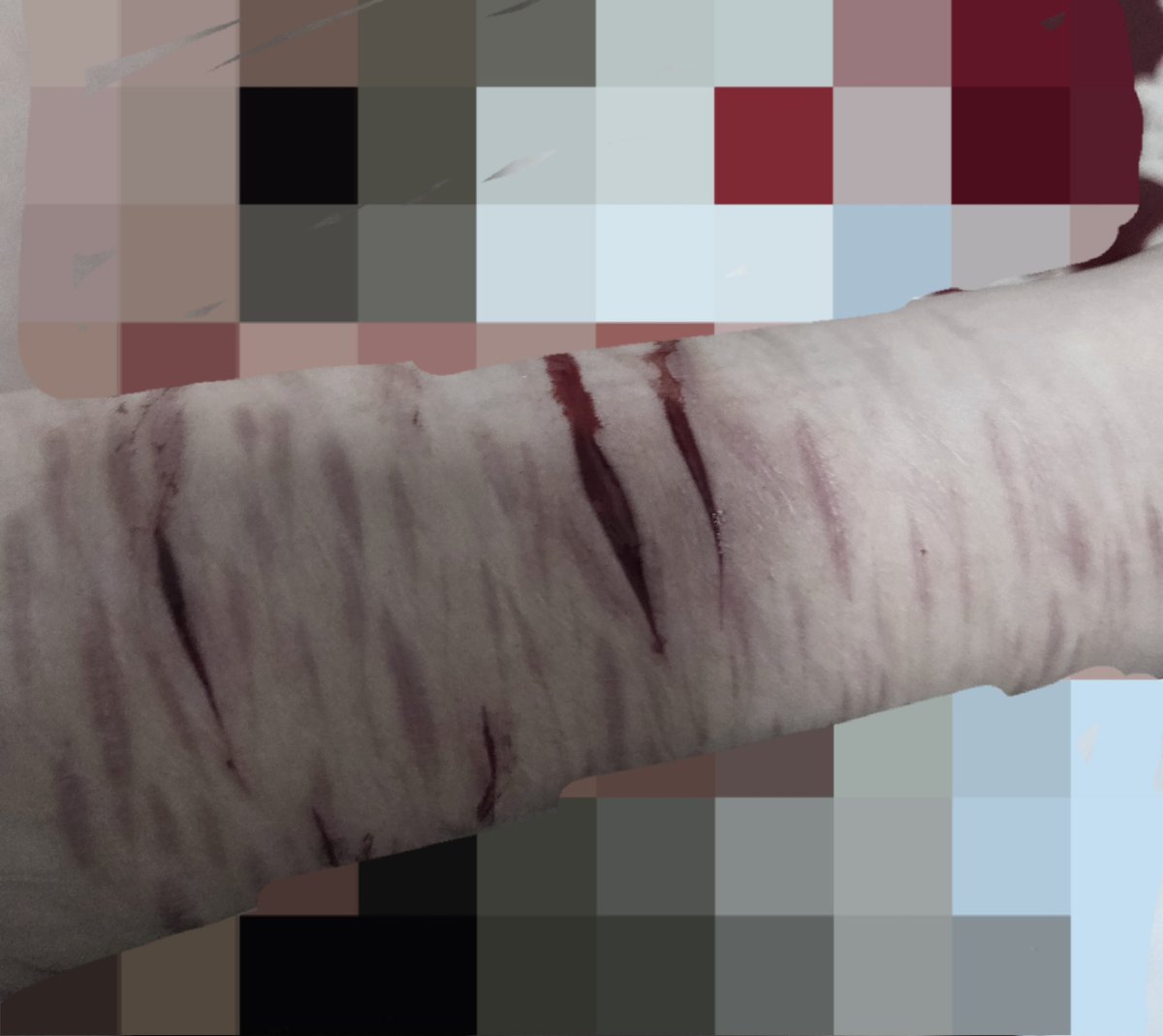901kiskms's tweet photo. 요즘에는 자해를 깊게 해도 안 아픔

#자해전시  #selfharm https://t.co/EvsRBloC97