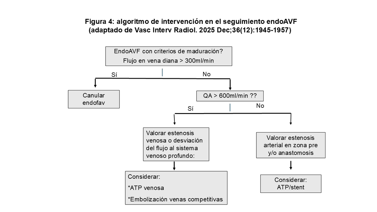 SENefrologia's tweet photo. 🆙 ACTUALIZACIÓN en #Nefroaldía @nefroaldia👇
🫀 Fístulas Arteriovenosas Endovasculares (endoAVF)  
✍️ Sagrario García Rebollo, Pablo de la Fuente Gebauer, Jorge Senkichi Uchiyamada  
🔗 https://t.co/ucTd1IL4Aa https://t.co/mcgG01OLlY