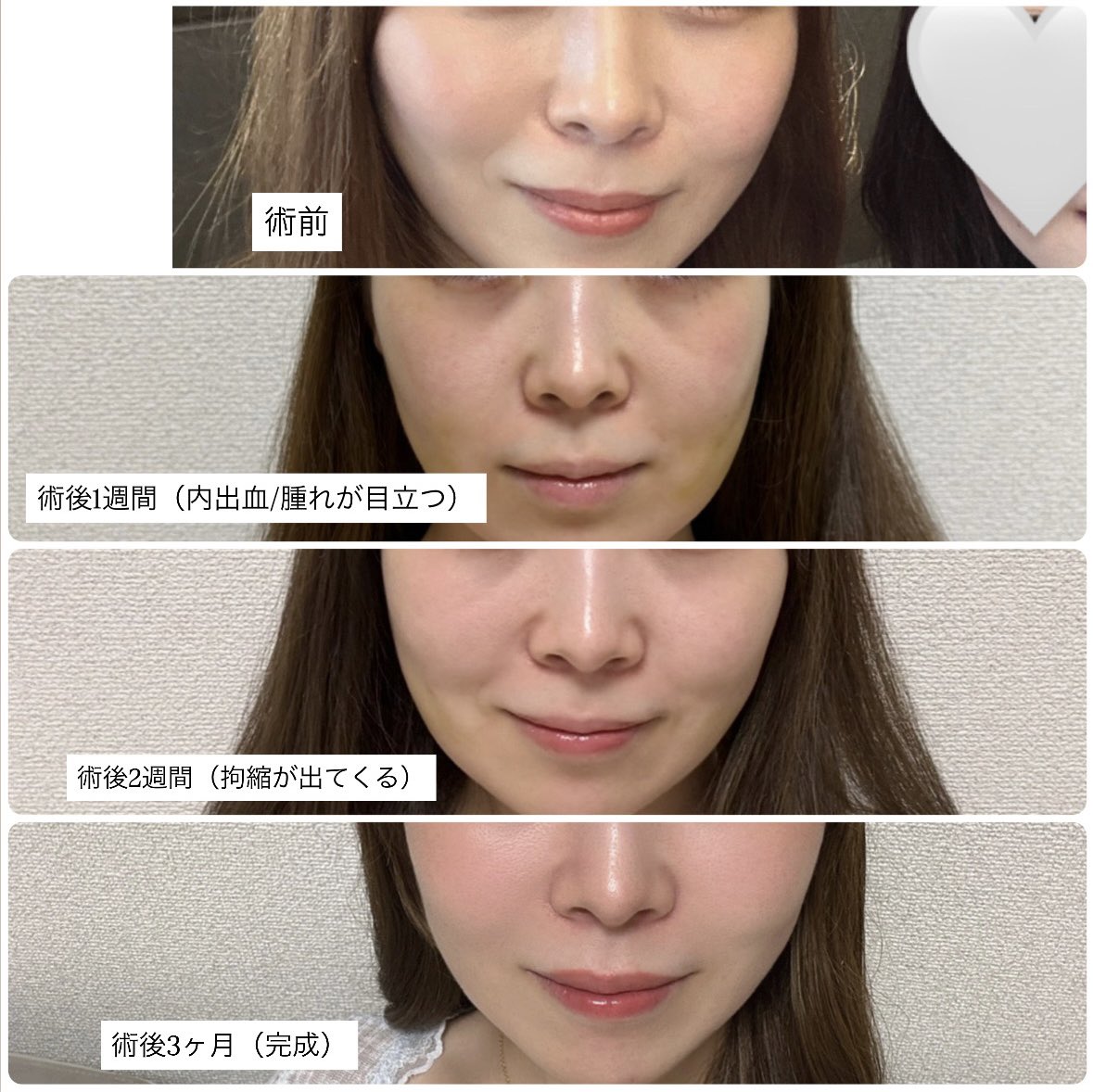 クロコダイル tweet media