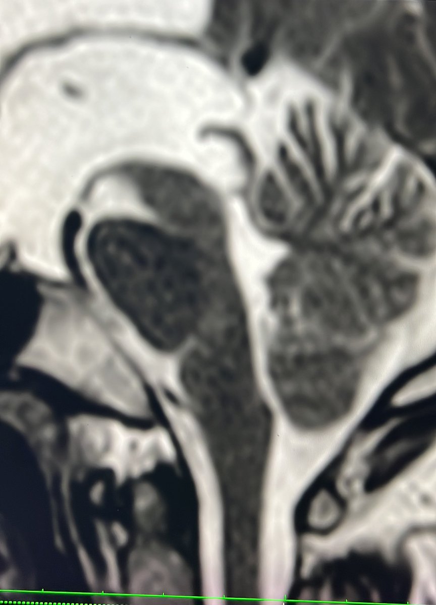 RGovindiah's tweet photo. #radres https://t.co/hbWBKr7Nfh