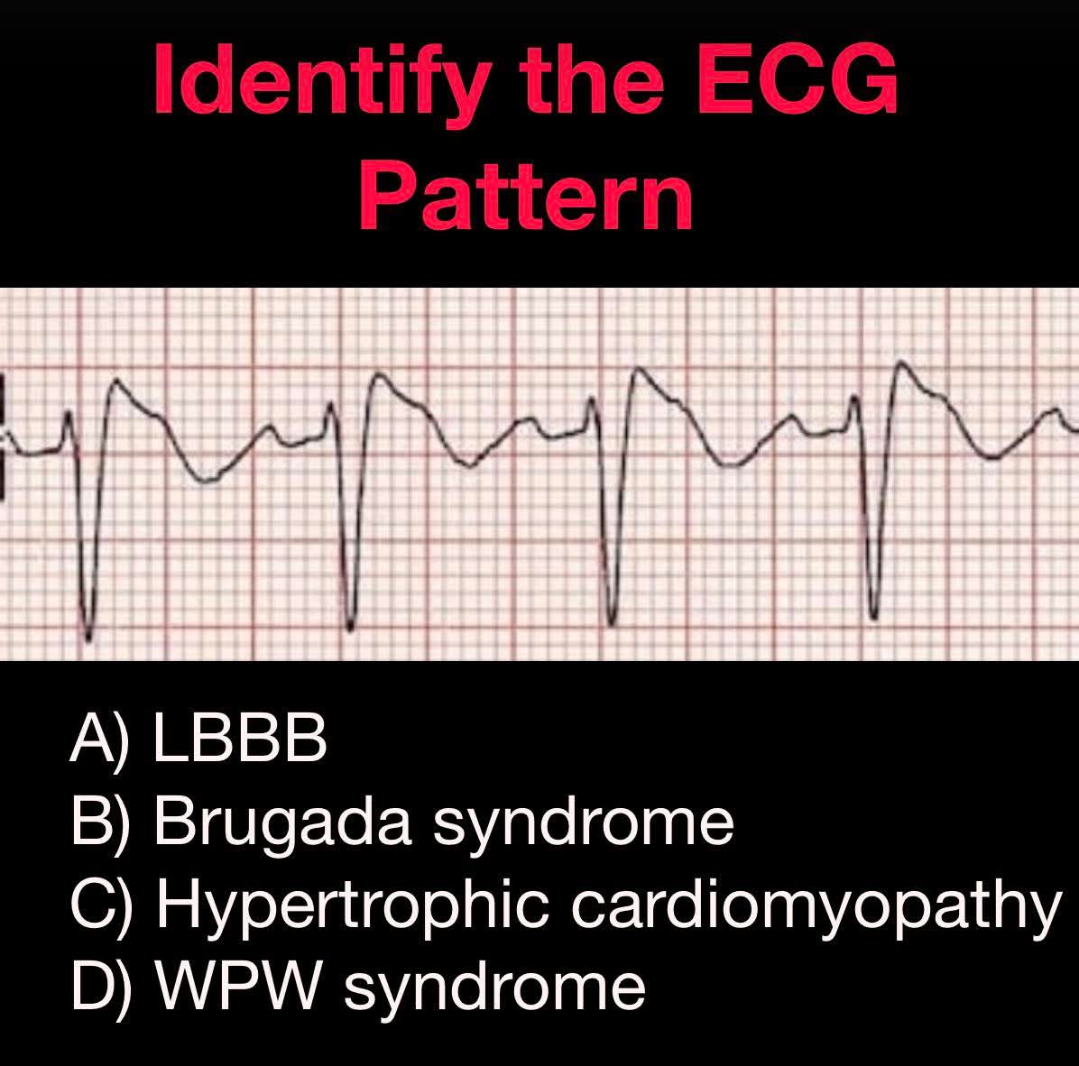 Leticia bravo Aldecoa 🧠 & ♥ tweet media
