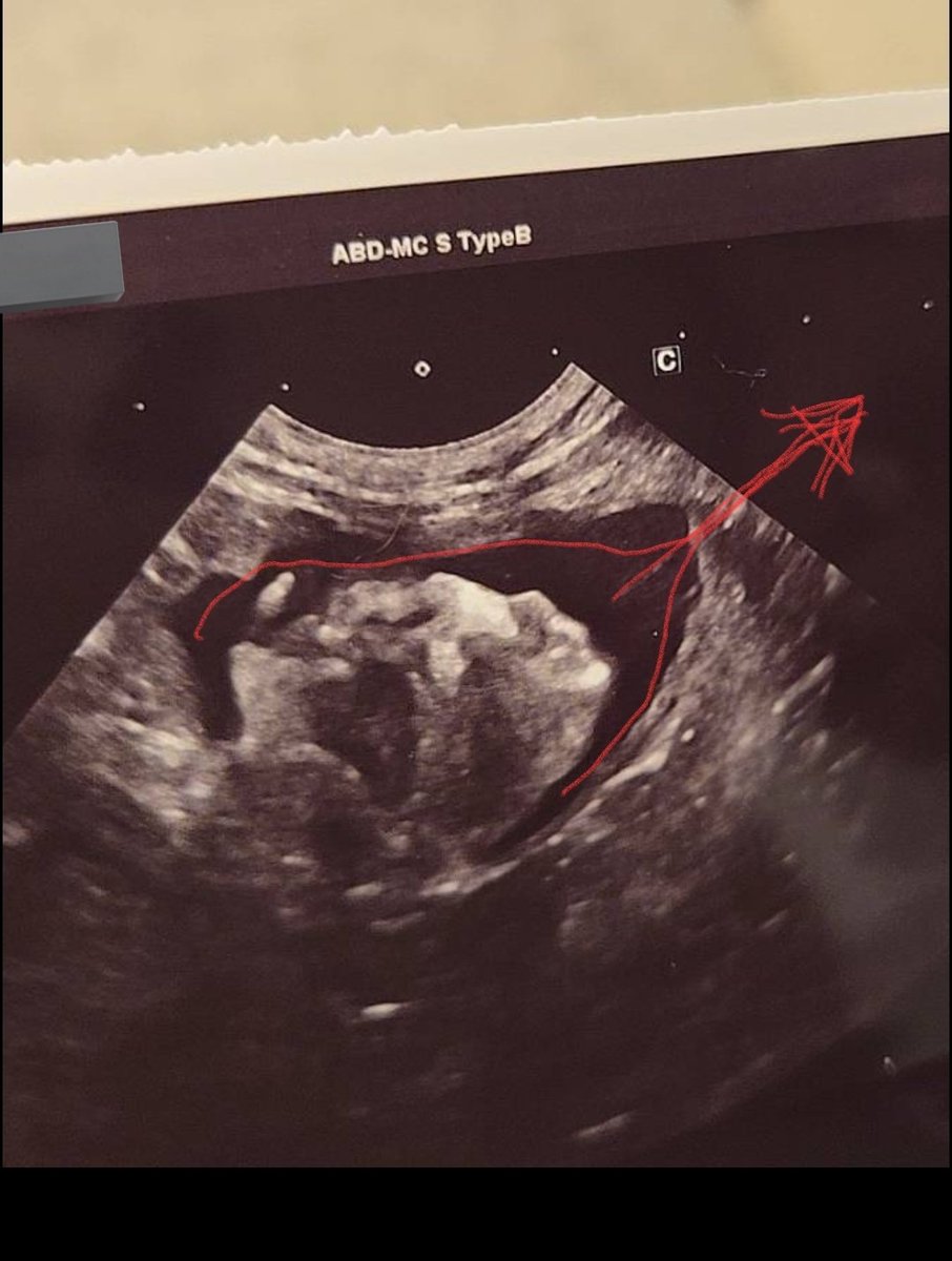 サフラン tweet media