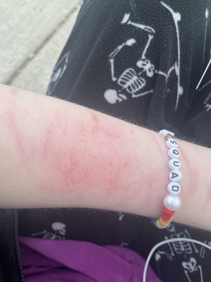 fancyfranciezzz's tweet image. some scratching I did before school #shtwt #scratching