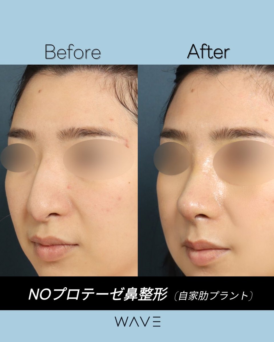 WAVE医院 |鼻手術専門 tweet media
