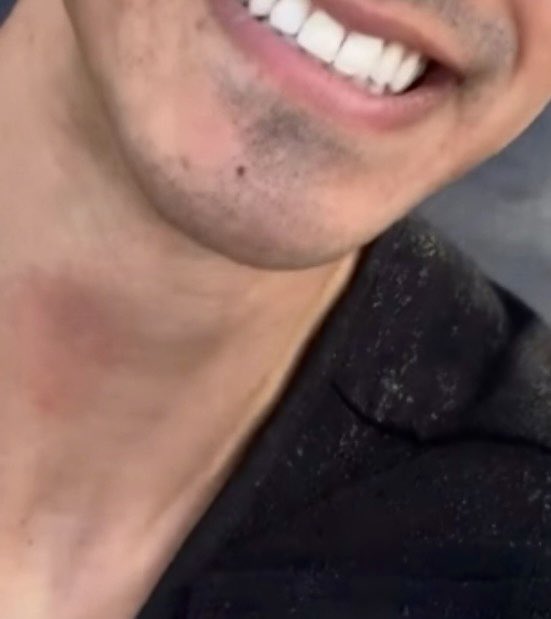 asksiriwhoks2y's tweet image. Sir, may I ask the mark on your front neck 👀? (They finally got to Chiang Mai!!) #TodTime #Time #Tod #lovex #LoveXReality