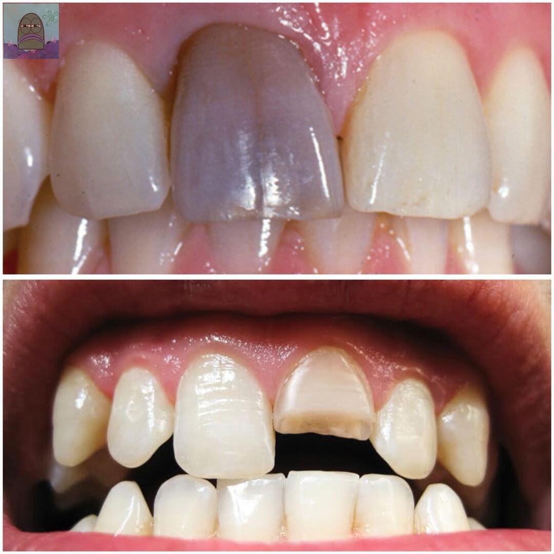 Tanyarl 💚 tweet media