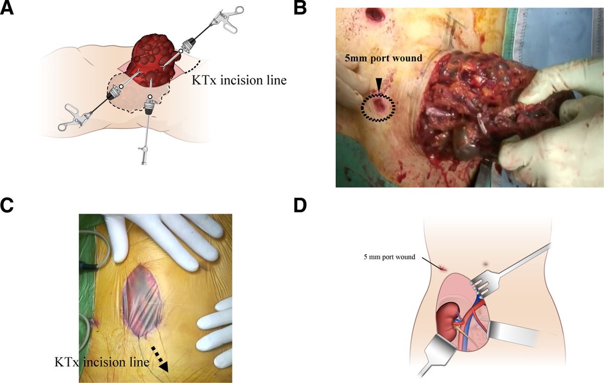 TransplantDirect tweet media
