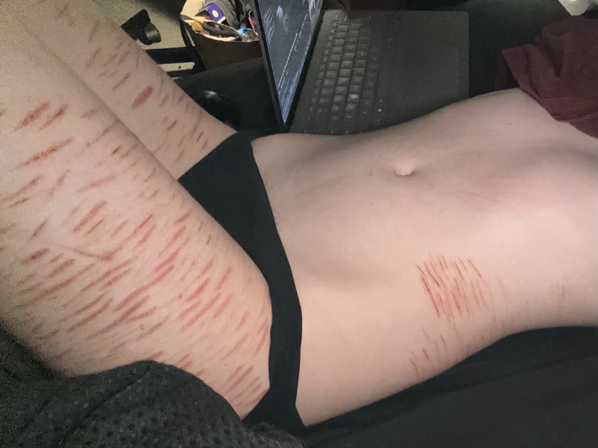 ۫ ᩧ𝓘ꪗꪖꪀ 𓐇۪. ડꫝtׁׅ᭙tׁׅ . tweet media