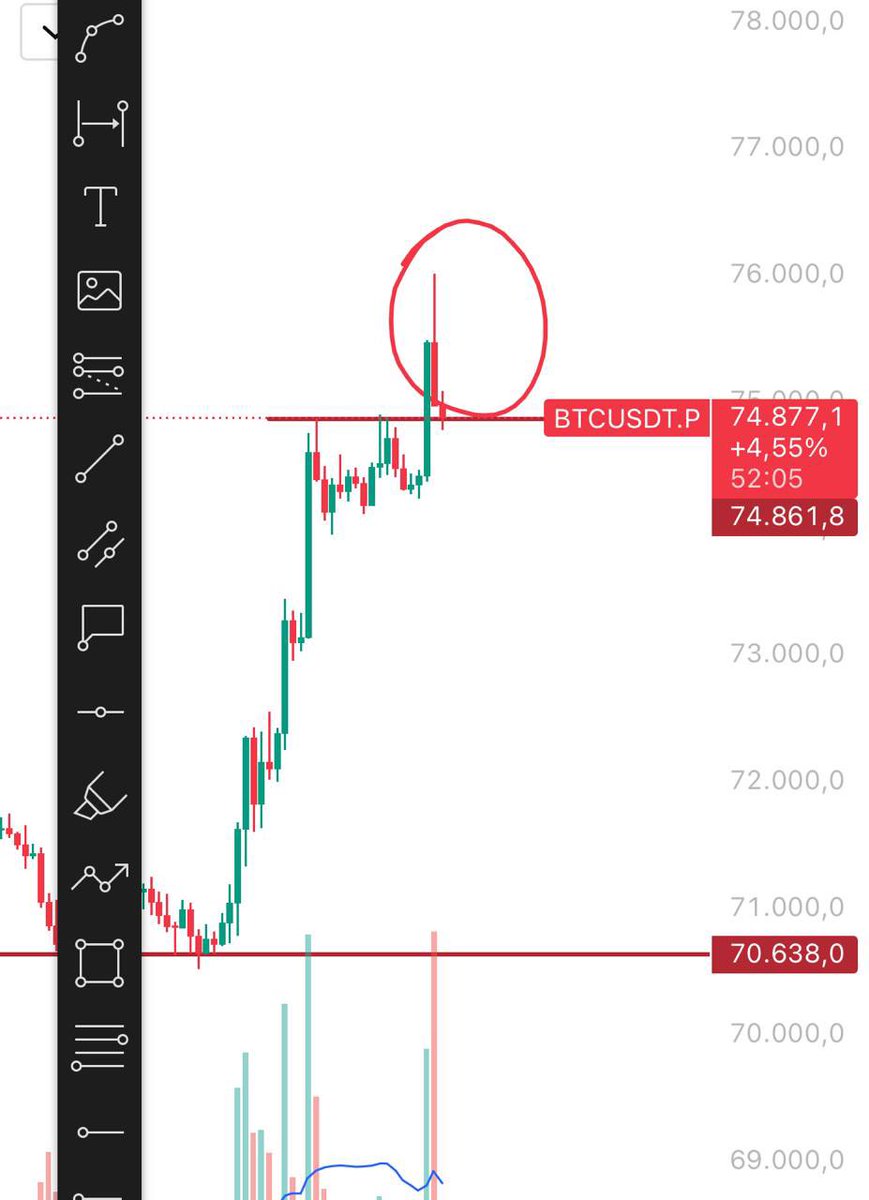 Chartist | Süleyman 💲🦁 tweet media