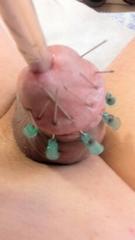 cbt摘蛋 tweet media