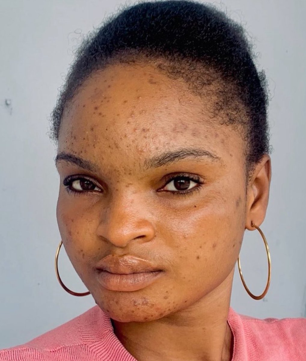 fowoshere🪄 tweet media