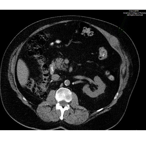 American College of Radiology tweet media