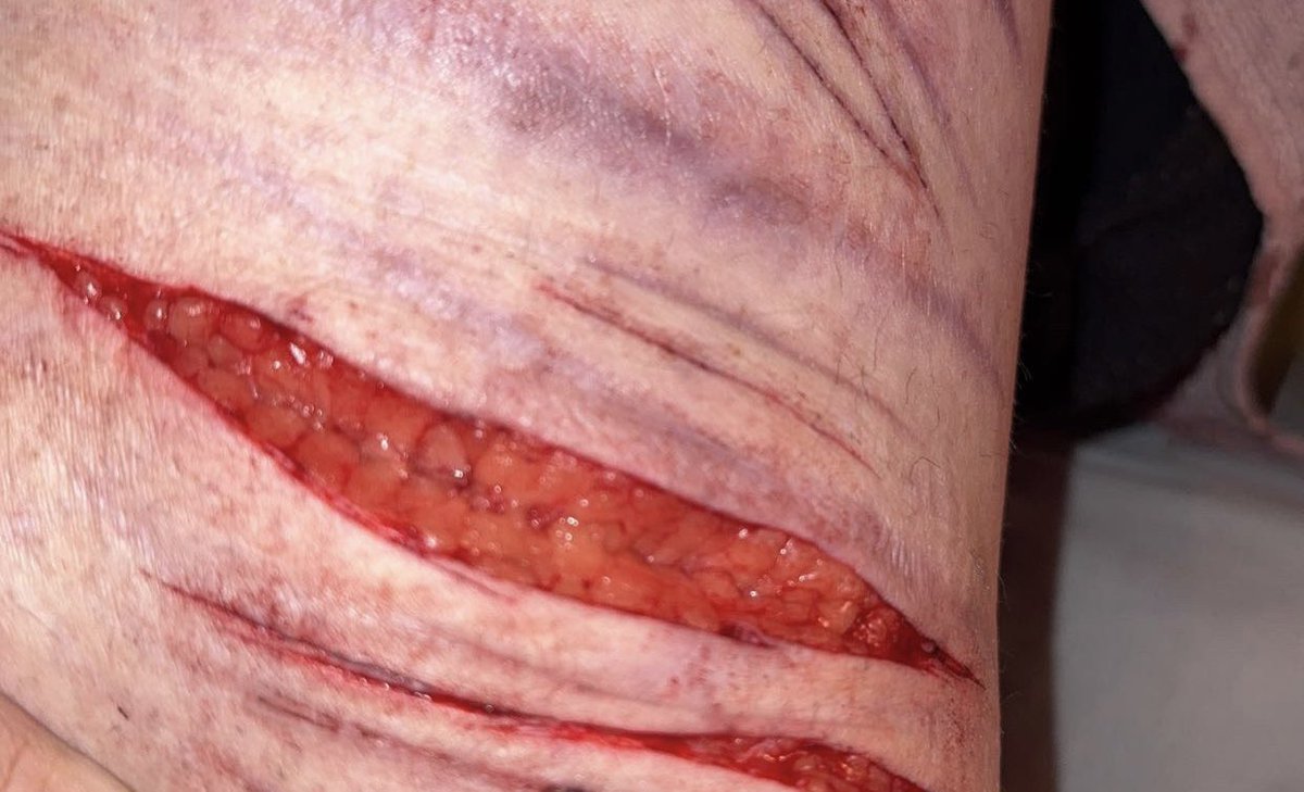 dixi_iii's tweet photo. ALL FAKE 

GOING TO CUT AGAIN TONIGHT Yeye
( this is from the other night ) https://t.co/j8LWiIzkBH