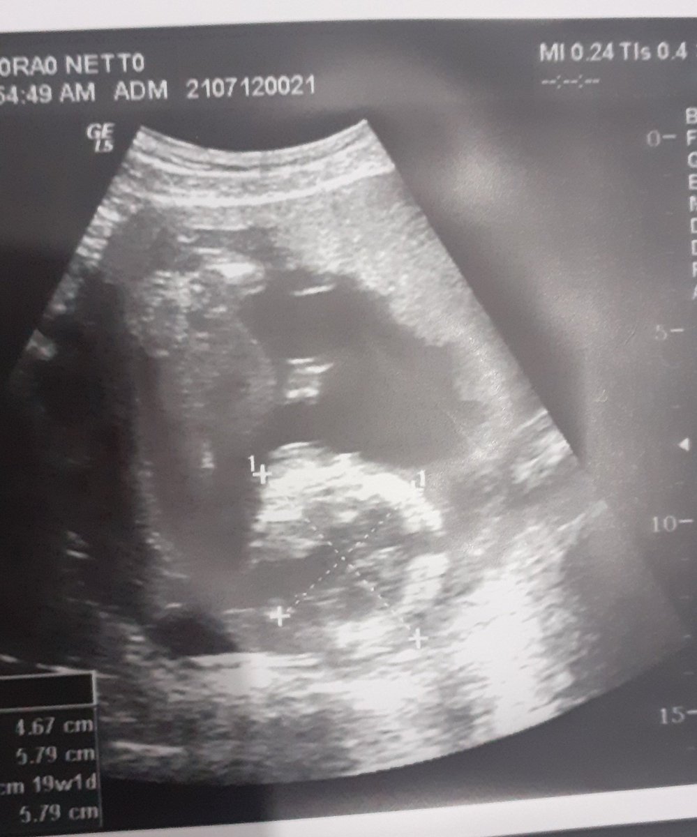 carolinda ✨ tweet media