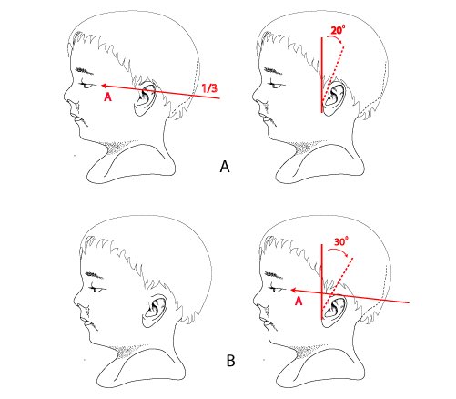 Jack Murdoch MD tweet media