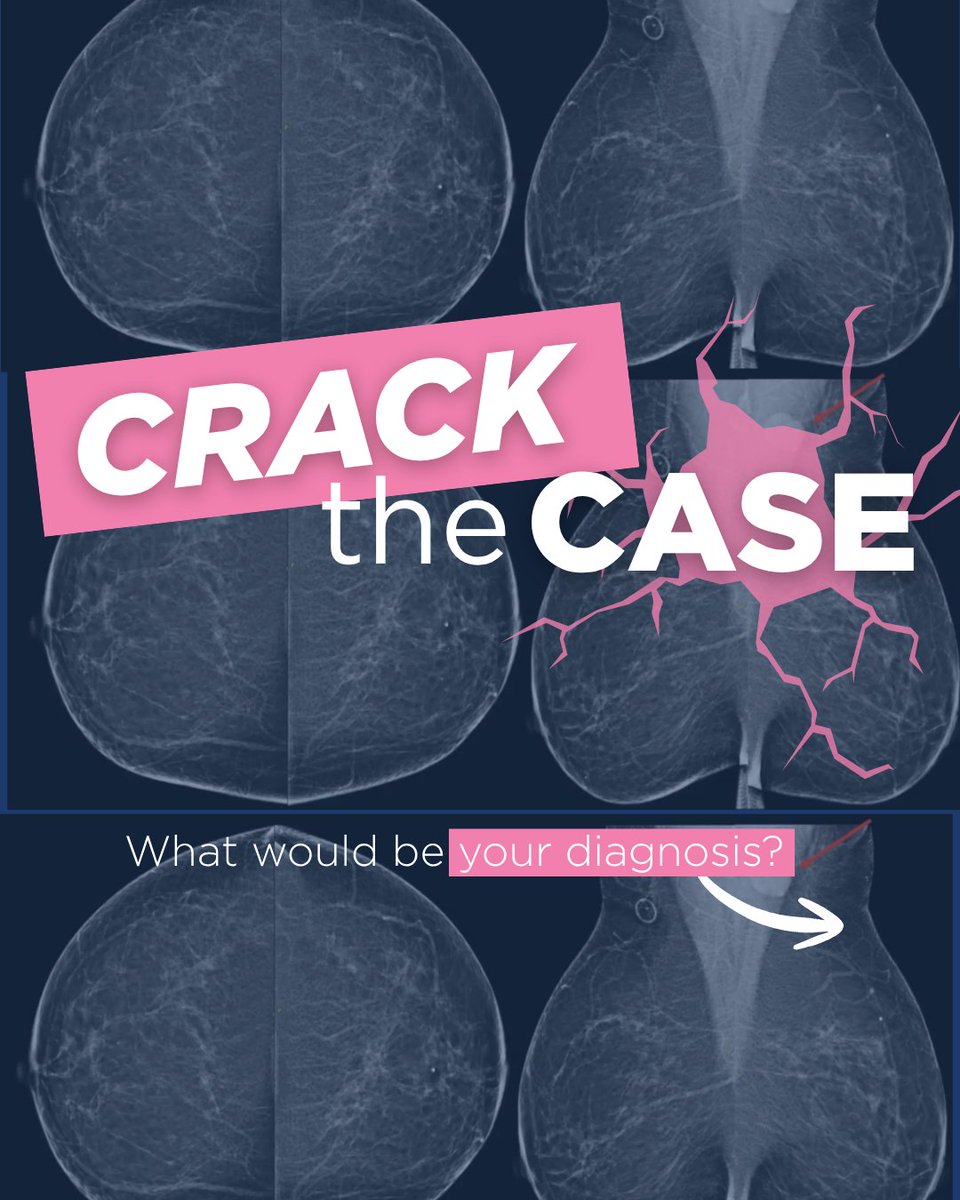 Society of Breast Imaging tweet media