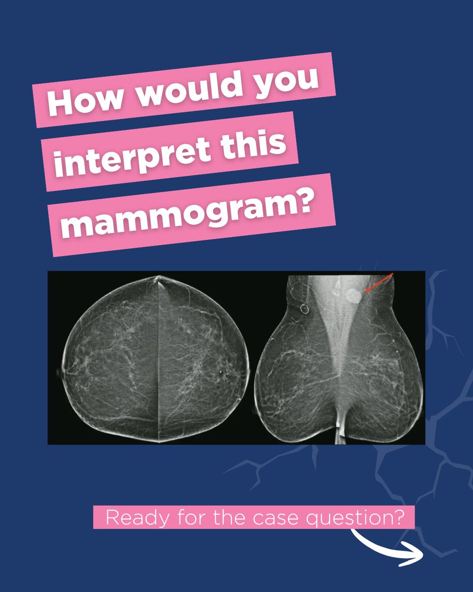 Society of Breast Imaging tweet media