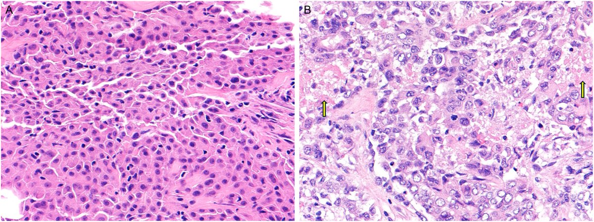 Human Pathology tweet media