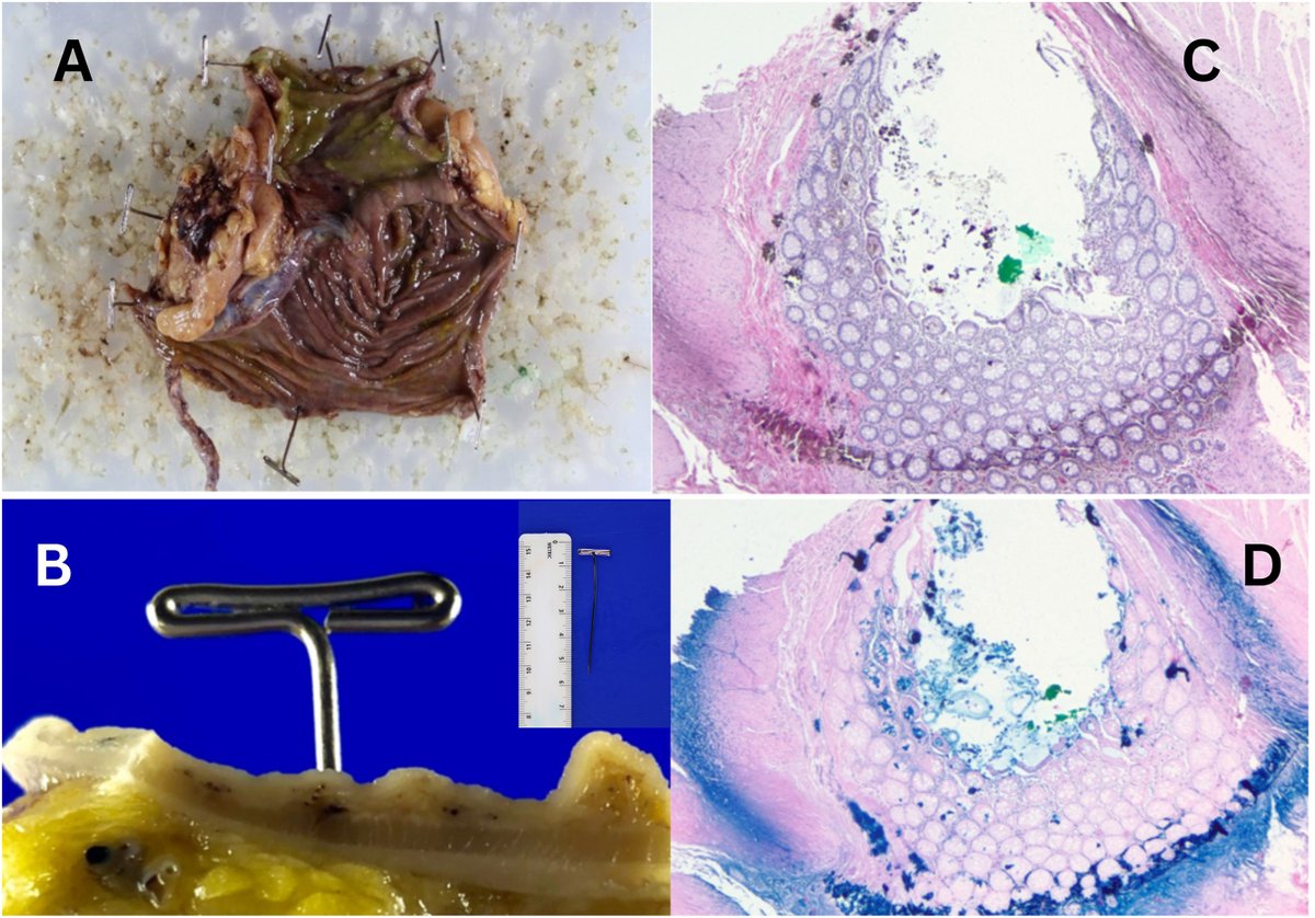 Human Pathology tweet media