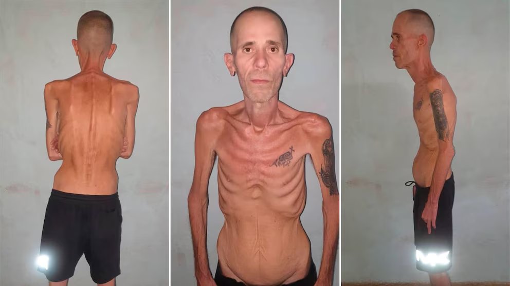 Así salió en libertad un preso político en Cuba. Estuvo 5 años detenido por pertenecer a la disidencia.
Esto es el comunismo, señores. Este es el pensamiento que defienden los Castro, Maduro, Chávez, Kirchner, Kicillof.